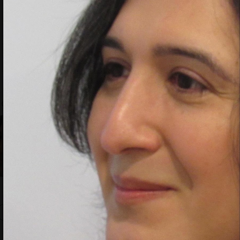 Rhinoplasty Before & After