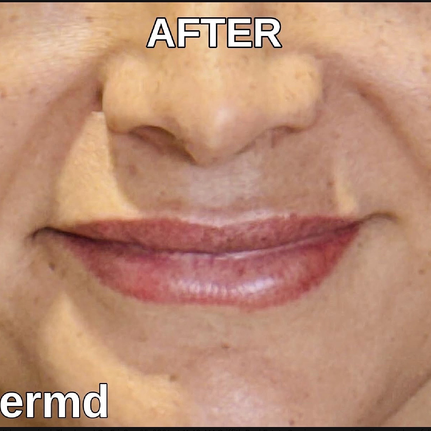Before & After