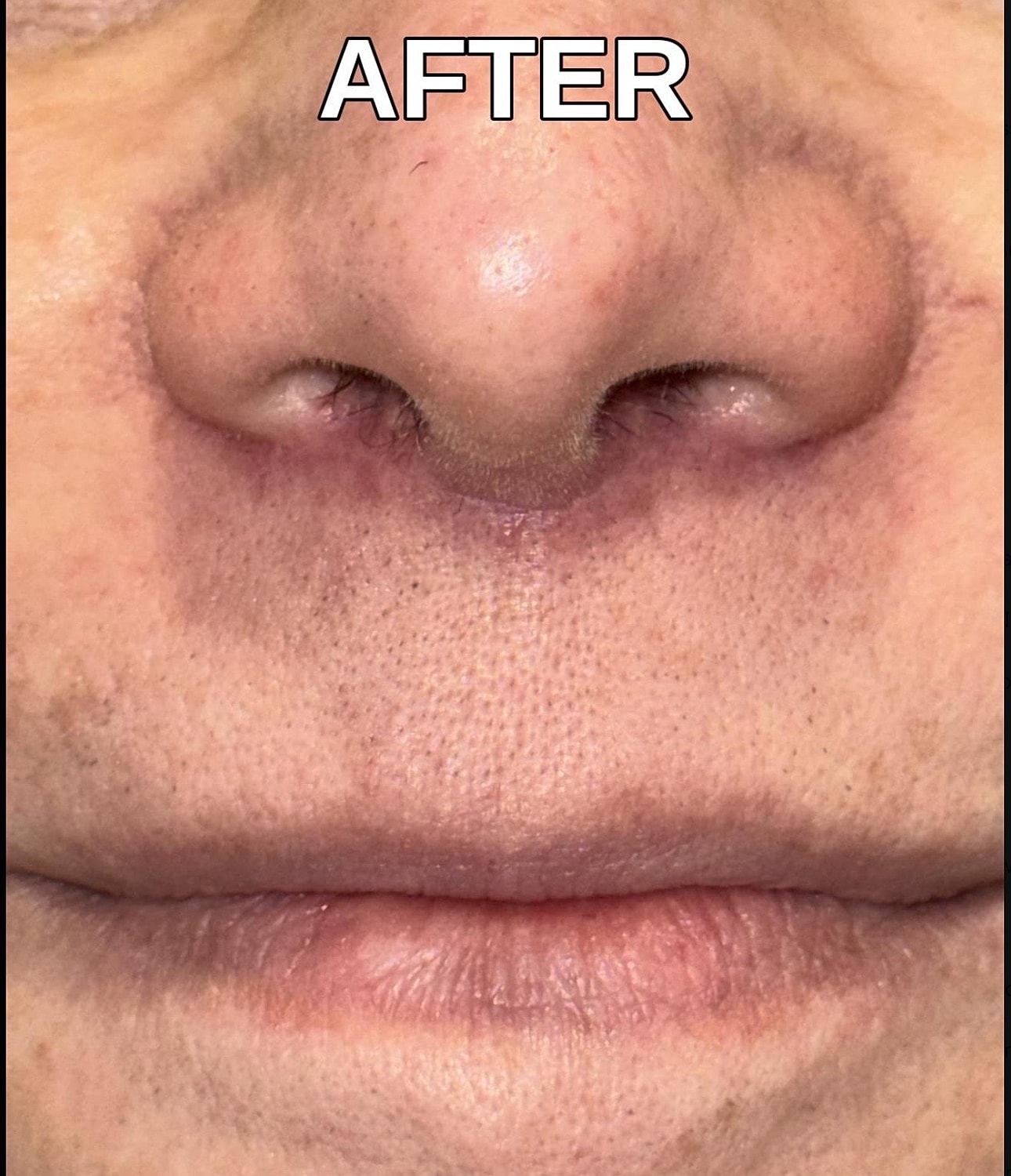 Before & After
