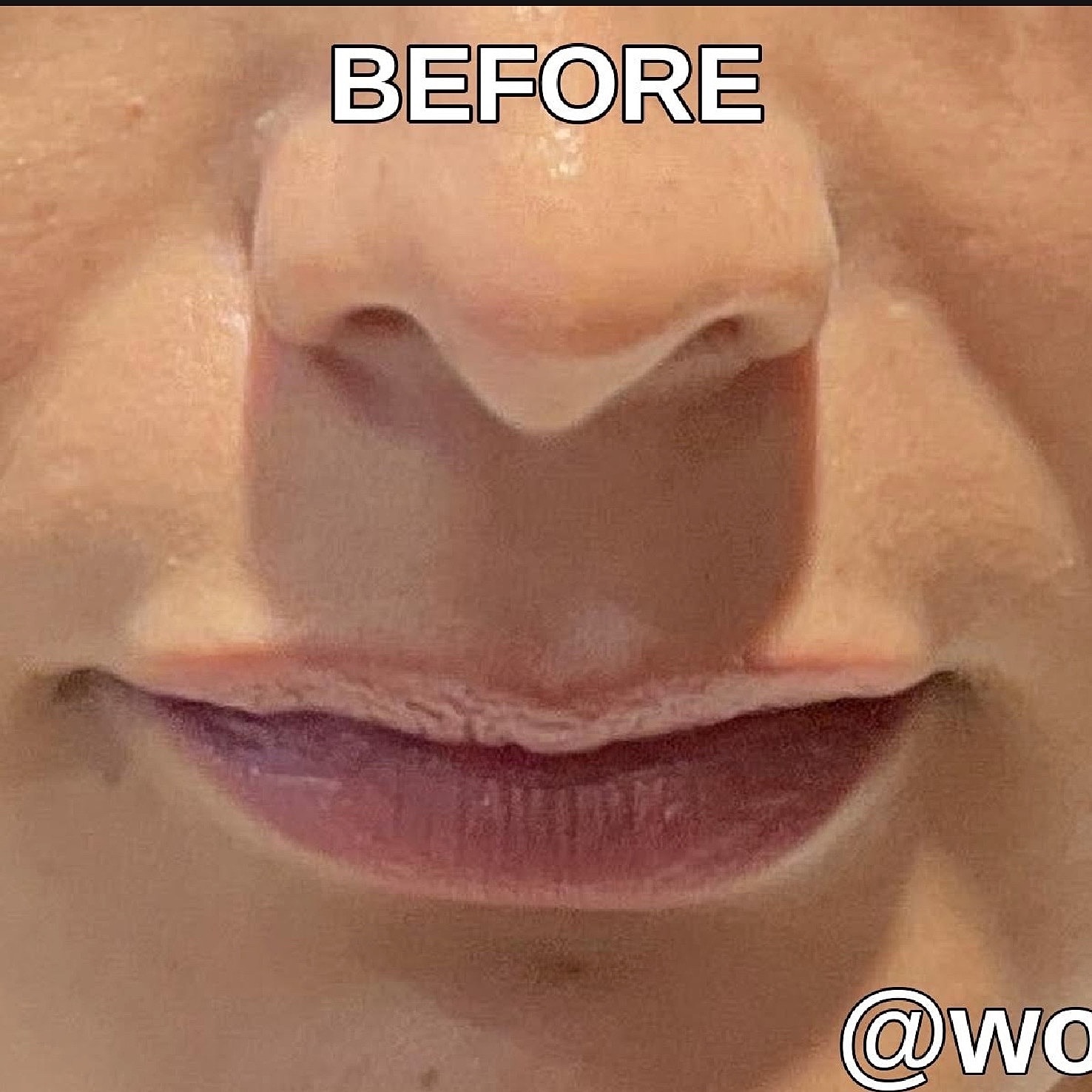 Before & After