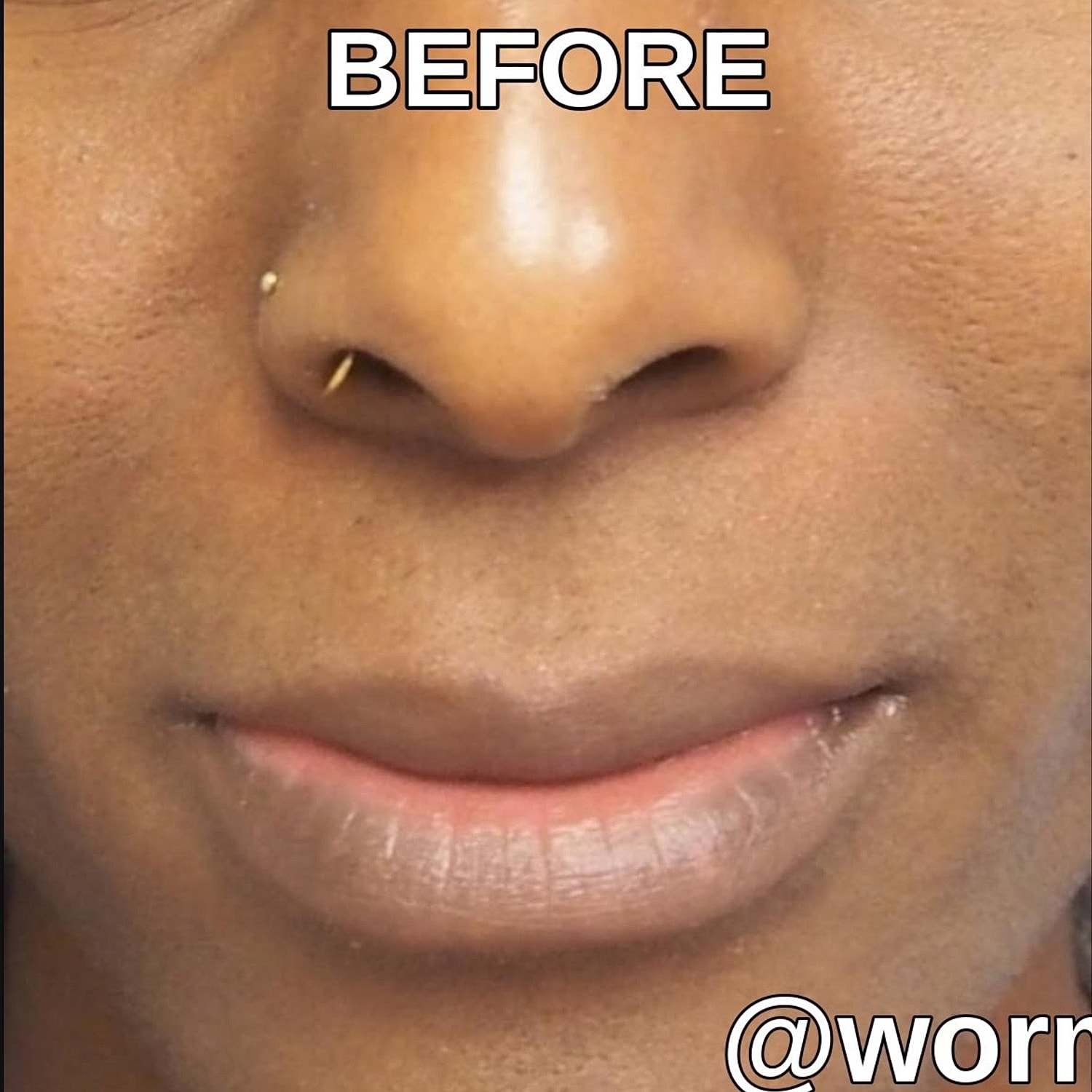 Before & After